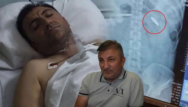 15 Temmuz’un Acı İzleri: Kurşunla Yaralanmış Hayatlar