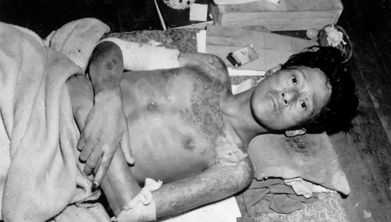 80 Yıl Sonra Nagasaki’den Çarpıcı Uyarı: Nükleer Felaket Tehdidi
