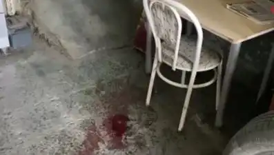 Sandalyeden Düşen Adamın Yaşadığı Korkunç Kaza Ve Sonrası