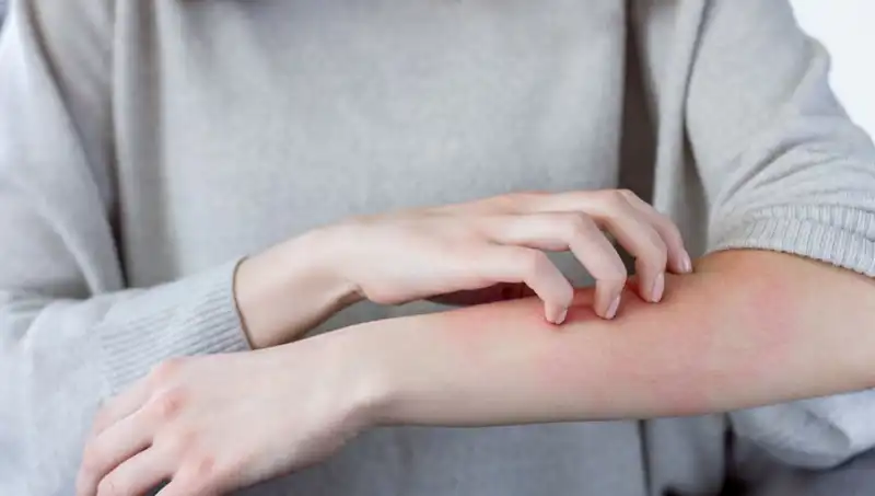 Cilt Kanserinin Gizli Belirtileri: Dermatolog Açıklıyor!
