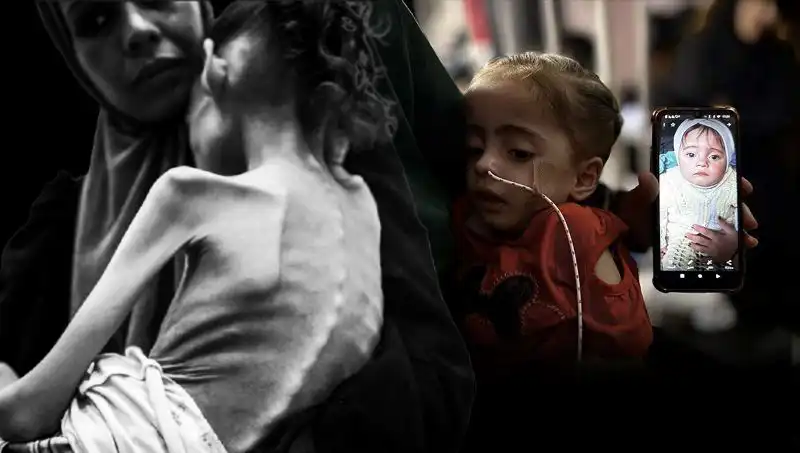 Küçük Meryem'in Dramı: 25 Kilodan 10 Kiloya Düştü