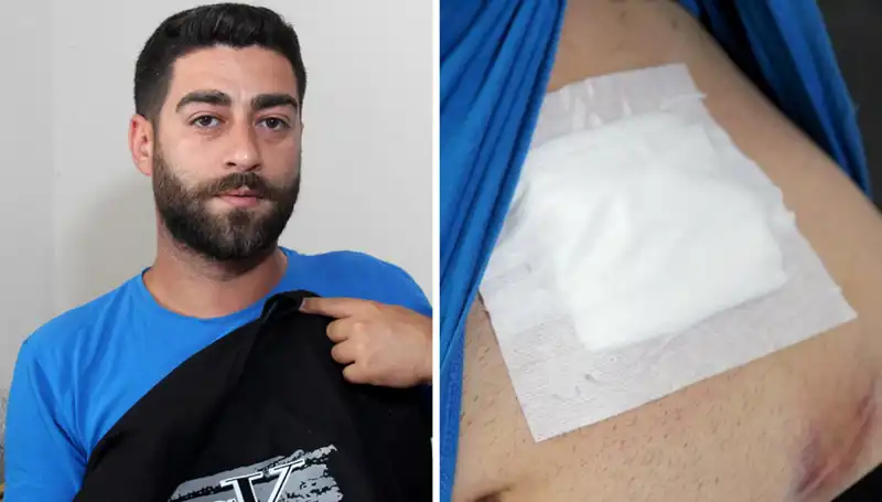 Karnında Hissettiği Ağrı, Hayatını Kurtaran Büyük Bir Tehlikeyi Ortaya Çıkardı